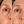 Precision Eye Lift