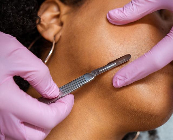 Express Dermaplaning